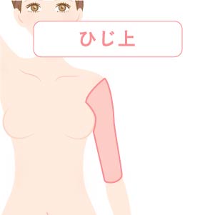 ひじ上医療脱毛料金