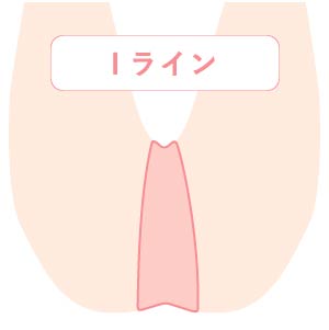 Iライン医療脱毛料金