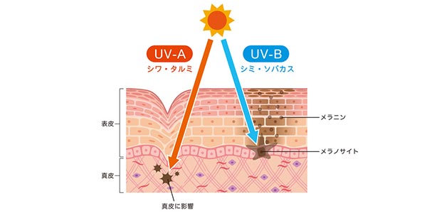 加齢による皮下組織と皮膚の変化