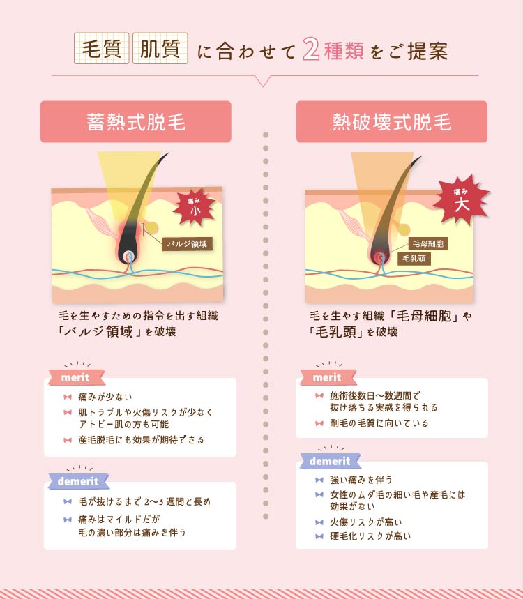 脱毛原理