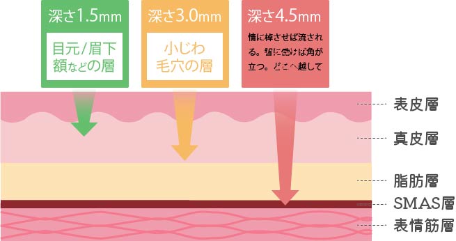 照射パワーについて