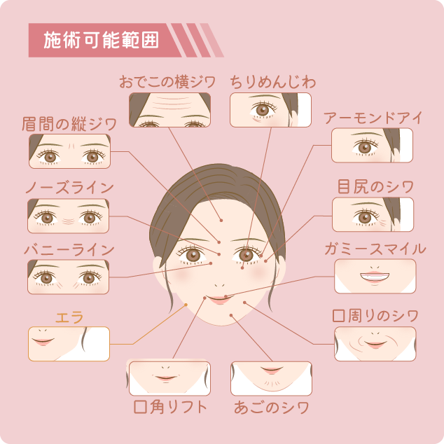 施術範囲