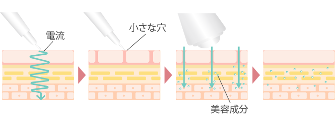 デルマシオとは