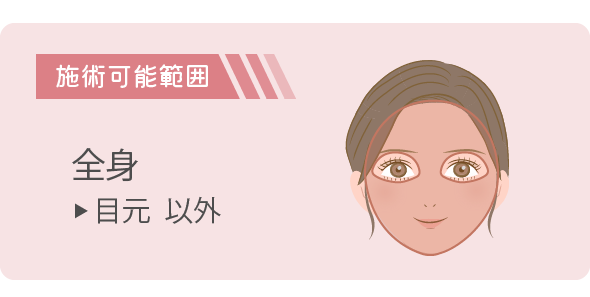 施術範囲