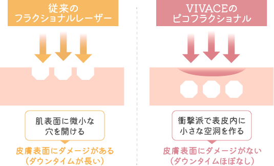 ピコフラクショナルの仕組み