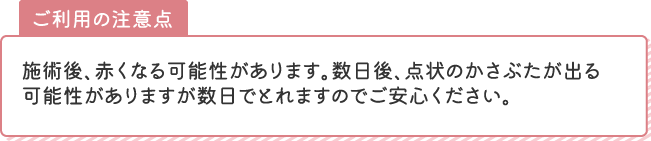 注意点