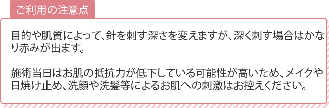 注意点