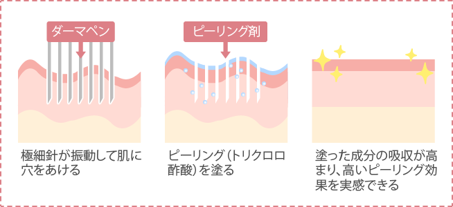 ヴェルヴェットスキンとは