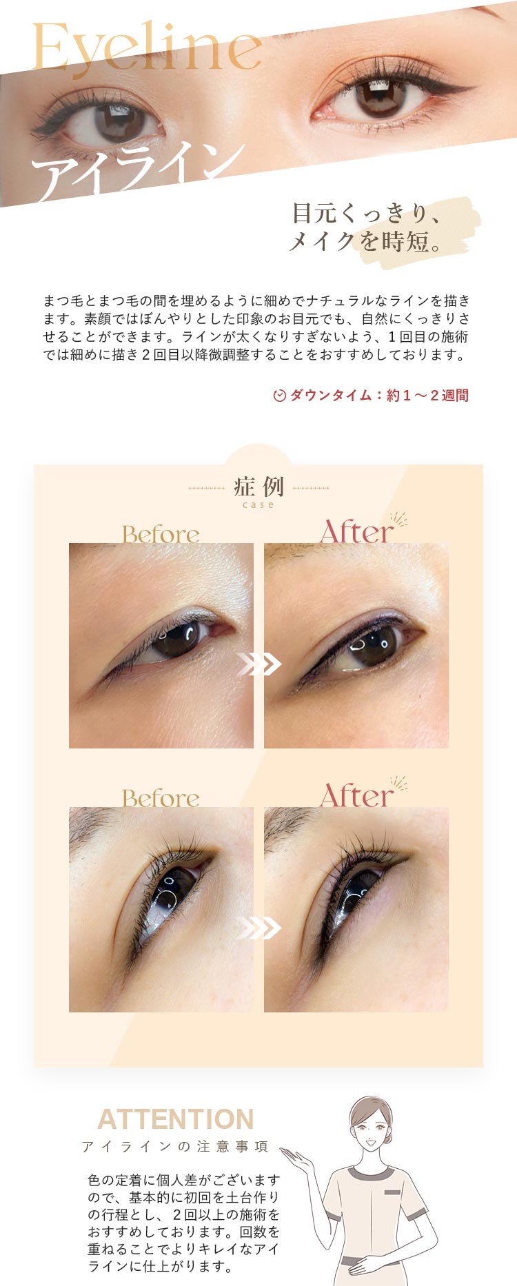 アイライン