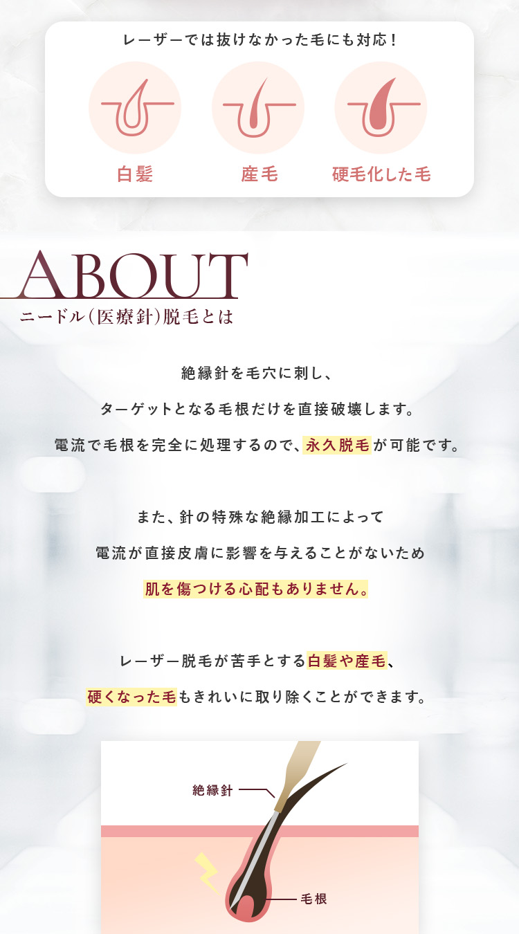 ニードル脱毛とは