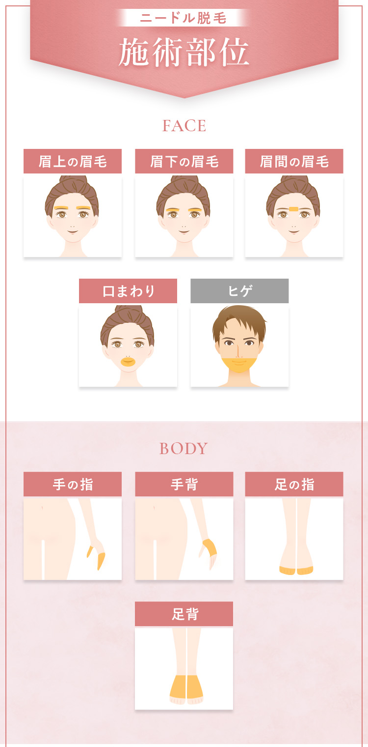 施術部位